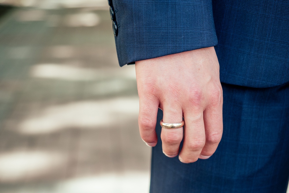 Wedding Ring On Mans Arm Closeup 